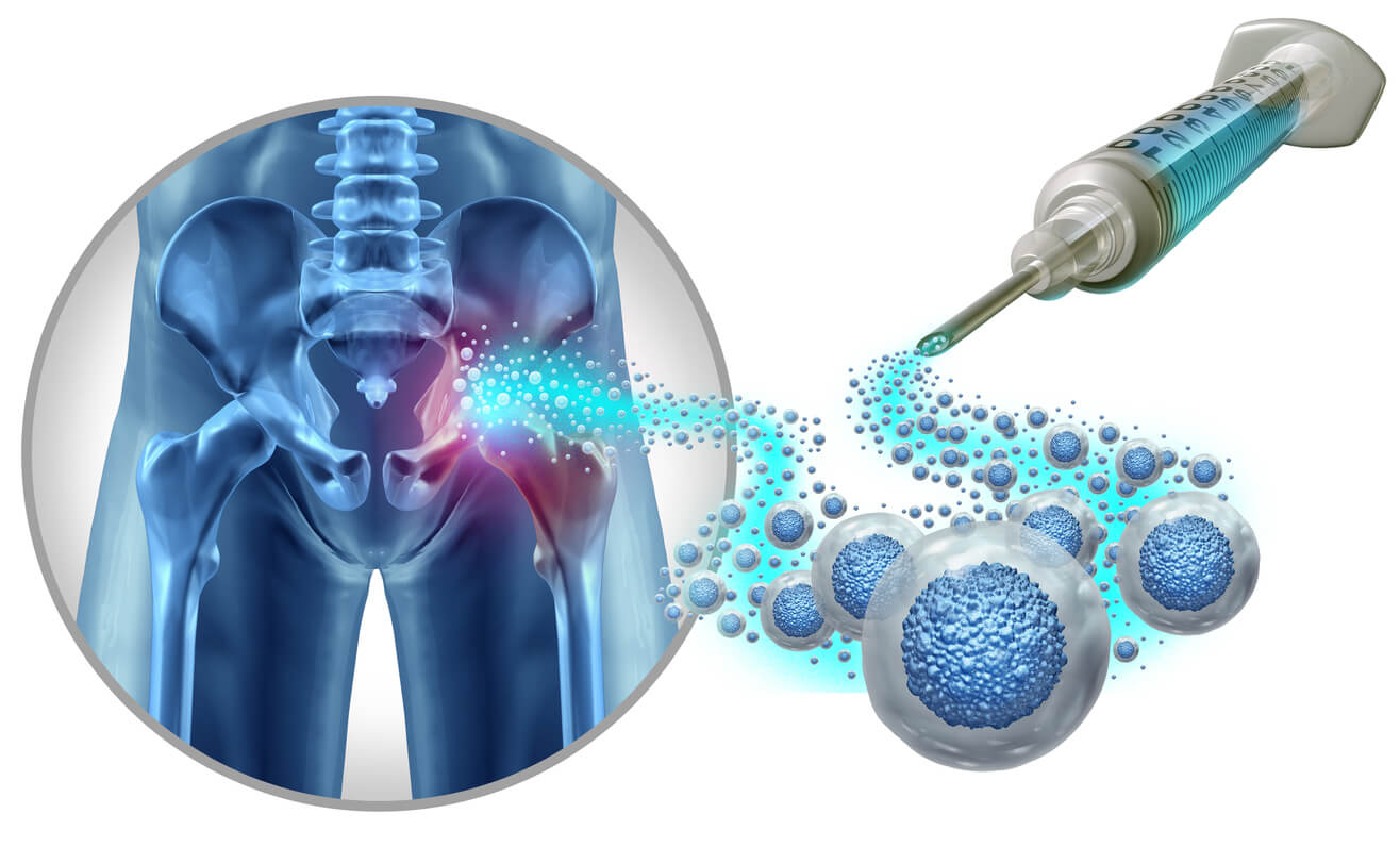 how much does stem cell therapy cost