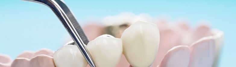 complete dental care