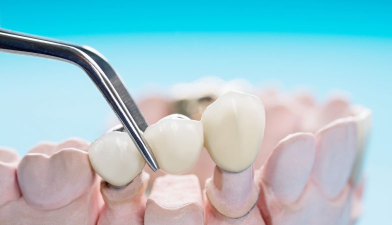 complete dental care